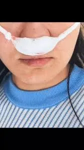 Телесные повреждения